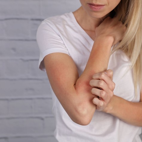 Már véresre vakarta magát a fiatal nő, akinél először ekcémát diagnosztizáltak – a viszketés végül daganatot jelzett című cikk nyitóképe