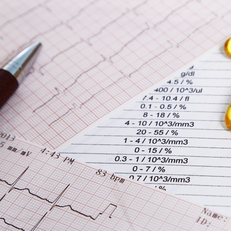 Épp egy gyakori koleszterincsökkentésre ajánlott vitaminról derült ki az, hogy szívrohamhoz vezethet!  című cikk nyitóképe