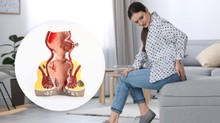 Lüktető fájdalom és makacs váladékozás a végbélből: felejtse el a házi kenegetést! Ez az egyetlen valódi megoldás a sipoly ellen című cikk nyitóképe