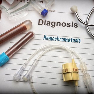 Hemokromatózis (Bronzdiabétesz): tünetei, vizsgálata és kezelési lehetőségei című cikk nyitóképe