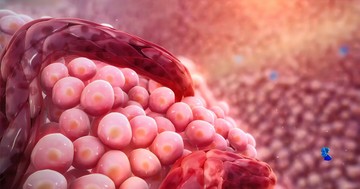 6 súlyos tévhit a rákról: például tévedés, hogy mind gyógyíthatatlan