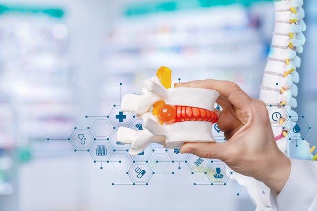 Gerincsérv – mikor kell műteni?