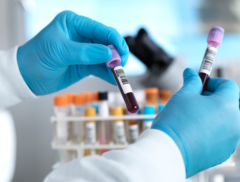 magas májenzim értékek oka májbetegség zsírmáj