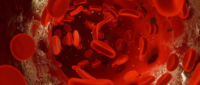 Előjöttek a trombózis tünetei valakinél a családban? Önre is veszélyes lehet! című cikk nyitóképe