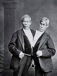 Orvostörténet: az igazi sziámi ikrek