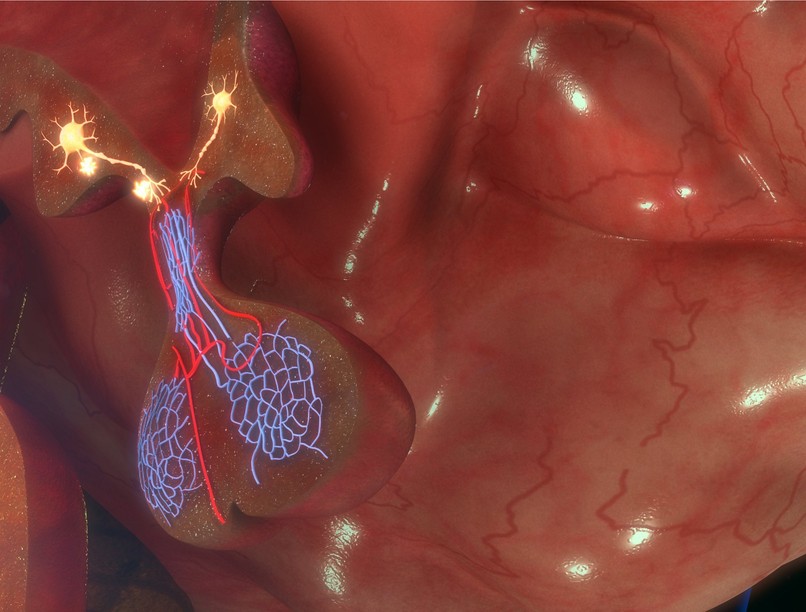 krónikus erős, fejfájás hipofízis agydaganat korai tünet