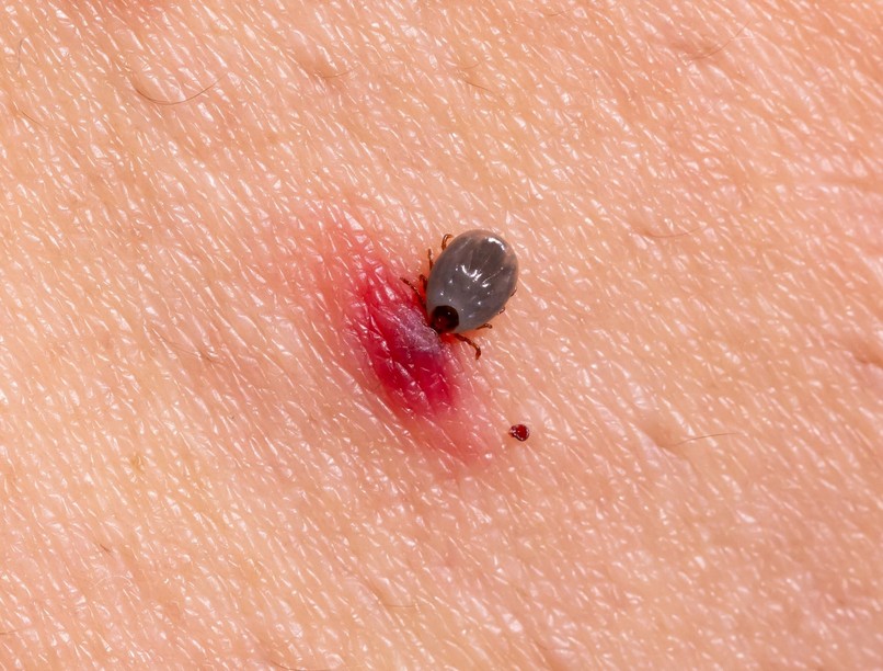 lyme-kór kullancs csípés helye piros