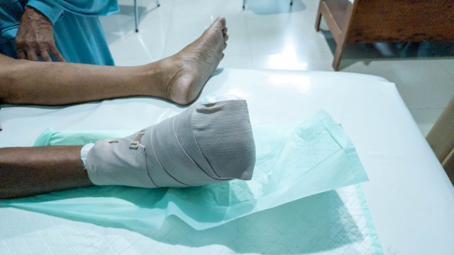 Bürger-kór tünetei, vizsgálataés kezelése