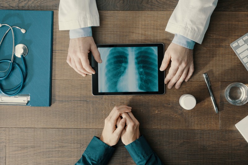 Tüdőrák: ezt teheti a diagnózis után magáért