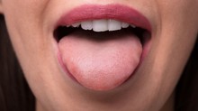 Hullámos, sárgás vagy piros? Ne hagyja figyelmen kívül ezeket a jeleket a nyelvén című cikk nyitóképe