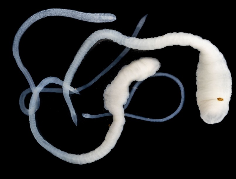 hasi fájdalom galandféreg tünetei ember