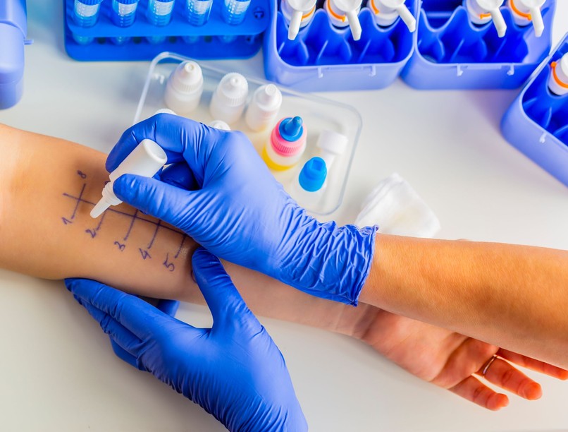 tüsszögés, orrfolyás, oka, jele, allergia tesz vizsgálatok allergológus