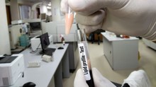 Felborult a lipidprofilja? Ezzel a 8 egyszerű lépéssel fellélegezhetnek az erei című cikk nyitóképe