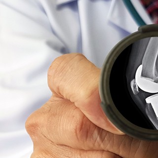 Mennyi ideig tart a felépülni csípő- és térdprotézis beültetés után? című cikk nyitóképe