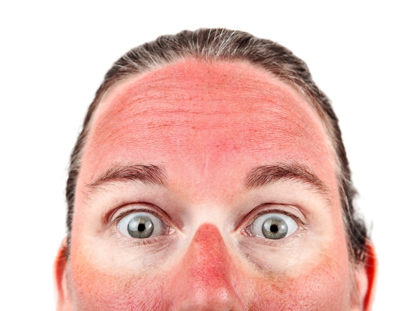 nap leégés szem látás UV sugárzás