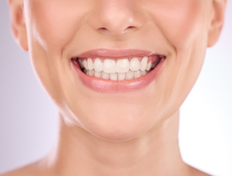 mesterséges intelligencia mosoly száj fogorvos