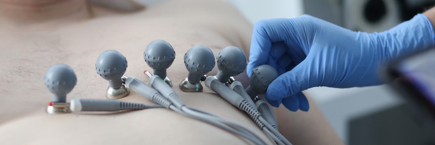 A diagnózis felállításához EKG, terheléses EKG, szívizom szcintigráfia (terheléses is), szívultrahang, coronarographia (koszorúérfestés) szükséges.