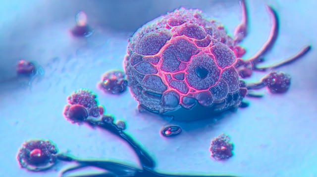 Amikor a nyomás átírja a rák kódját: a szöveti nyomás ellenállóbbá teszi a rákos sejteket