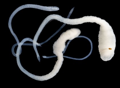 Ezek a tünetek jelezhetik azt, hogy galandféreg él a szervezetében című cikk nyitóképe