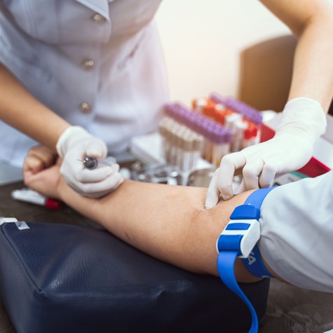 Vajon befolyásolhatja az edzés a laboreredményeit? Ha vérvérvételre készül, ezt érdemes tudnia! című cikk nyitóképe