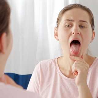 Lepedék a nyelven, dudor a szájban: ekkor jelez gombás vagy bakteriális fertőzést című cikk nyitóképe