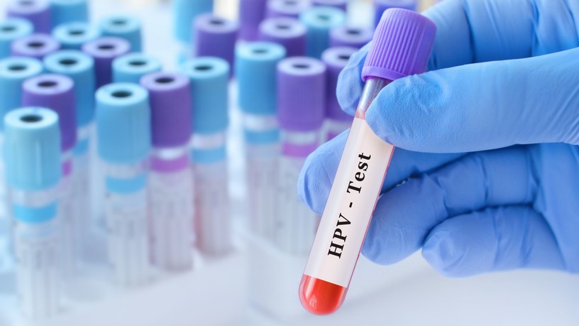 méhnyakrák szűrés HPV citológia orvos válaszol