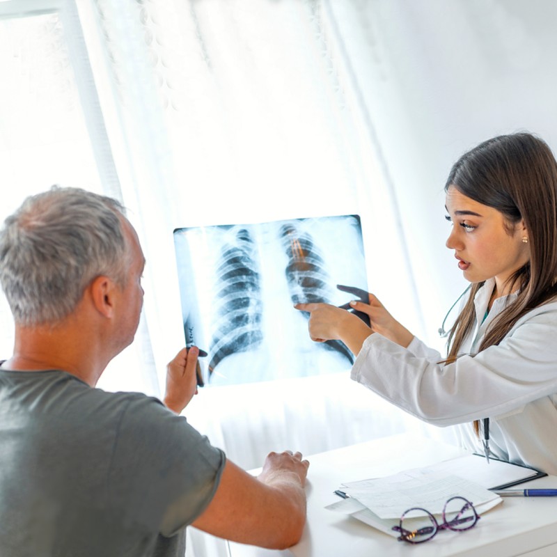 Ilyen a légzése tüdőfibrózis esetén - ne vegye félvállról a tünetet