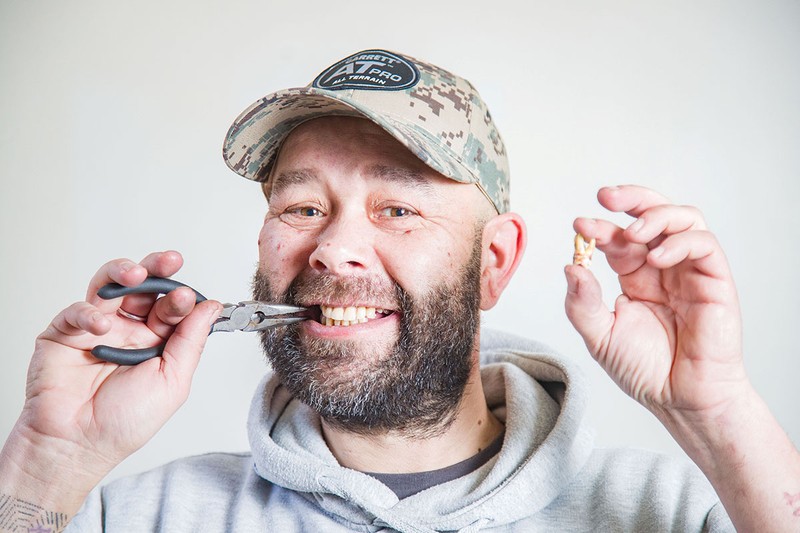 Hihetetlen: saját magának húzta, ki a fogát egy férfi, mert nem kapott időpontot a fogászatra