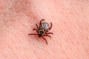 A Lyme-kór fázisai: hogyan fejlődik ki és mit tehet ellene?