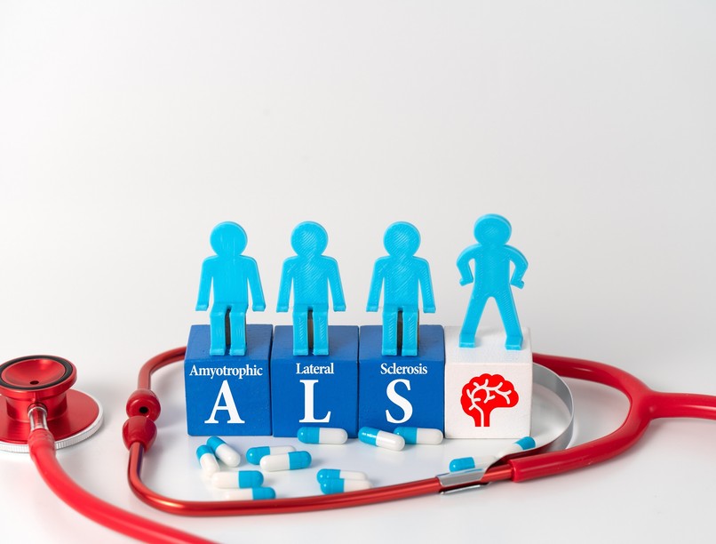 als betegség mitől alakul ki