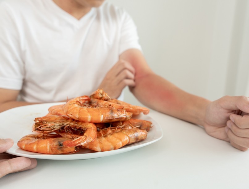 ételallergia felnőttkor nő