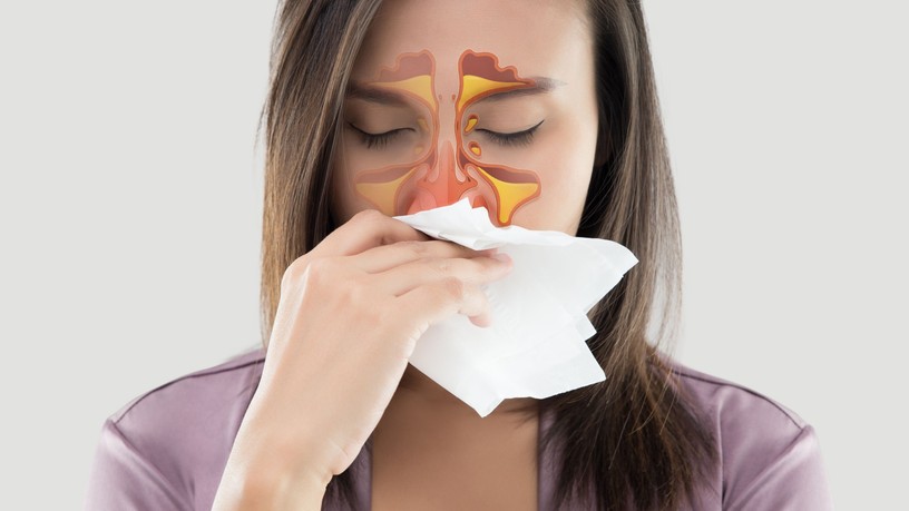 arcüreggyulladás okai orrpolip reflux