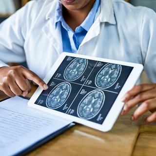 A gyógyíthatatlan daganattal diagnosztizált orvos már egy éve rákmentes ezzel a kezeléssel című cikk nyitóképe