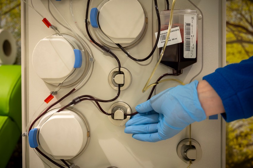 A plazmaferezisgép először a vér alakos elemeit választja külön a plazmától, a plazmát összegyűjtik, a donor pedig visszakapja az alakos elemeket, vagyis a vörös- és a fehérvérsejteket, valamint a vérlemezkéket 