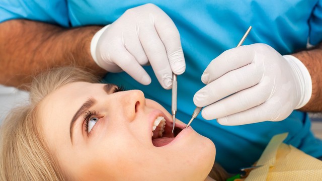 Ez dönti el, hogy lesz-e fogköve vagy sem