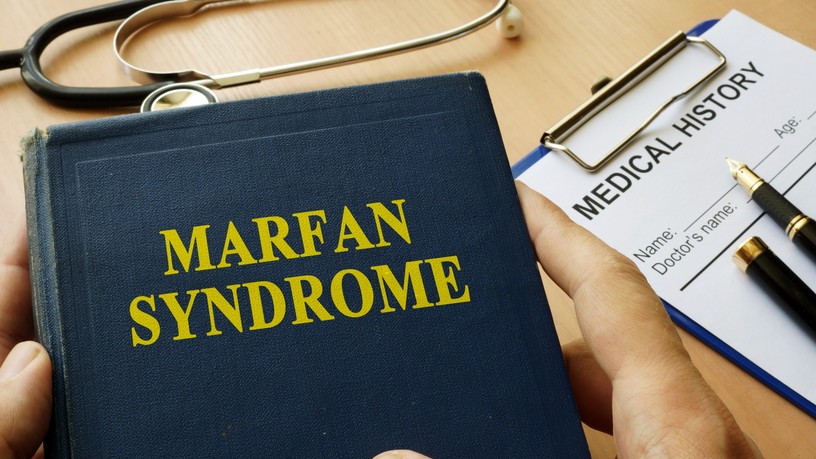 Marfan-szindróma tünet vizsgálat kezelés