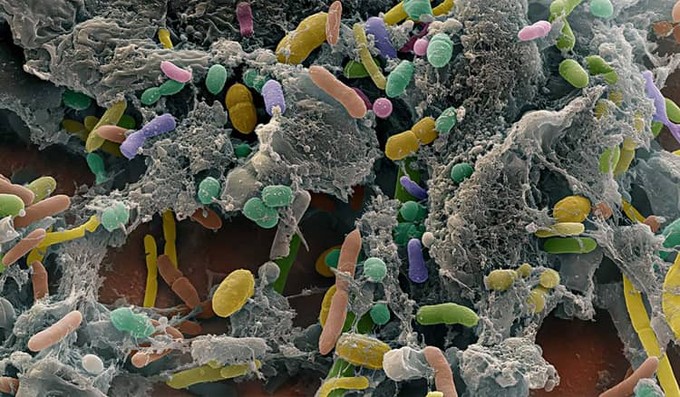 Szükségünk van a probiotikus baktériumokra! című cikk nyitóképe