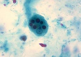 Olcsó gyógyszerrel a vérhas ellen?