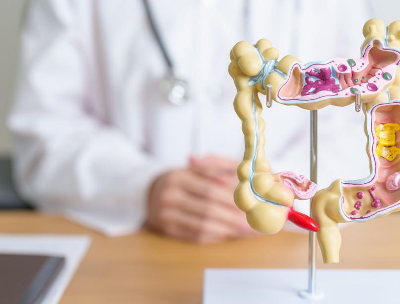 emésztési zavarok mikrobiom bélrendszer