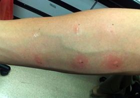 Mégsem vagyok allergiás?