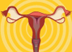 A medence-vizsgálat segíthet a petefészekrák felderítésében