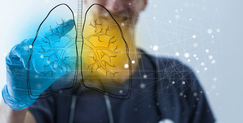 Történelmi mérföldkő a hazai pulmonológiában