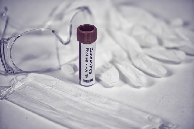 Koronavírus-teszt: Magyarországon is elérhető egy magán laboratóriumban!