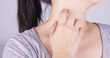  Bőrrák tünetek: ilyen korai jelekről ismerheti fel időben 