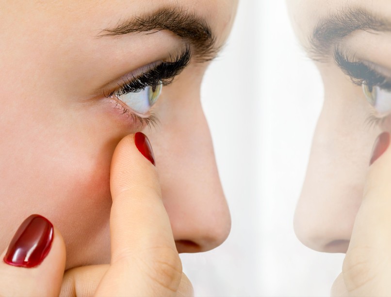 szem pötty szemdaganat folt tünet