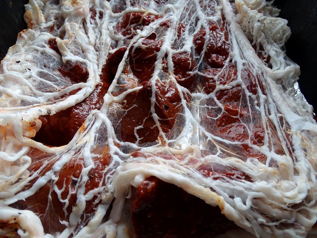 Mi a zsírmáj oka? Esélyesebb a kialakulása, ha ez a betegség rejtőzik el mögötte