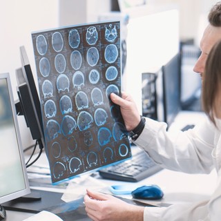 PTE-kutatás: közelebb kerülhetünk az epilepszia és a Parkinson-kór pontosabb felismeréséhez című cikk nyitóképe