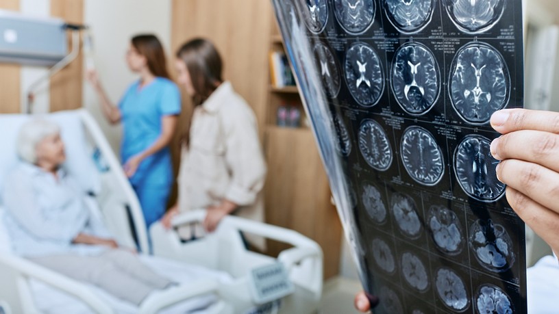 stroke tünet sztrók utáni maradványtünet izombénulás 