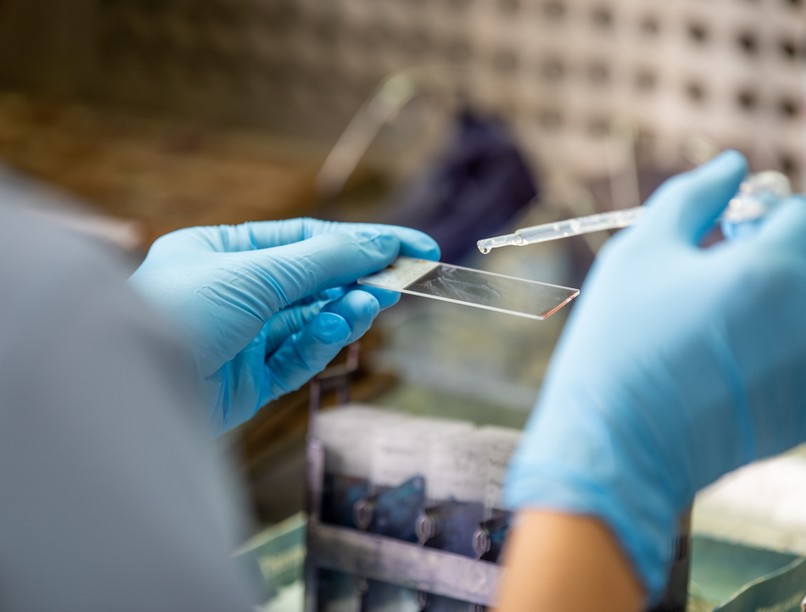 citológis, méhnyakrák, hpv, teszt, vizsgálat, szűrés