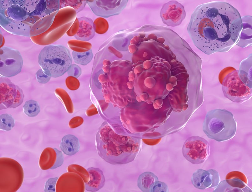 vérszegénység gyengeség fáradékonyság vérrák tumor